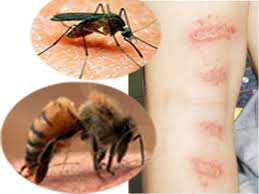 Côn trùng cắn - Hình ảnh minh họa